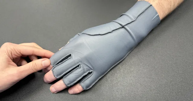 Manageing hand swelling using a compression glove with Ms Michelle Razo, Consultant Hand Therapist Belfast