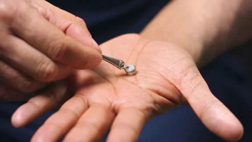 Close-up of the TOUCH prosthesis, the thumb CMC joint replacement implant, held in the palm of a hand